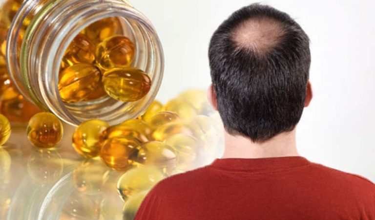 How can vitamins help in reducing your hair loss & other hair-related problems?